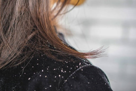 Flakes, Itch, Hair Fall? Your Scalp Might Be Asking for This