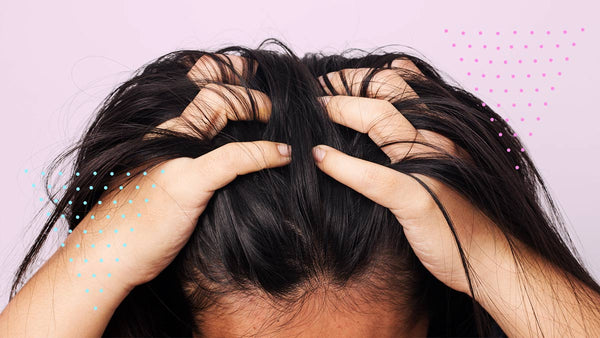 Everything You Need to Know about Natural Remedies for Dandruff